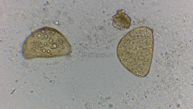 Яйца Dactylogyrus.